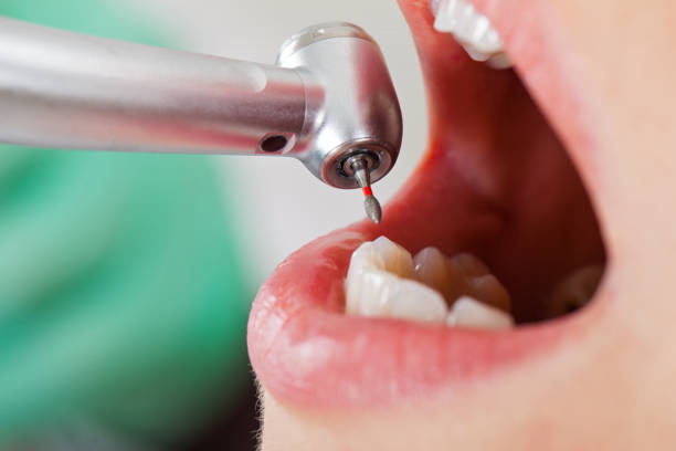 Best Tooth Infection Emergency Dentist  in Brawley, CA
